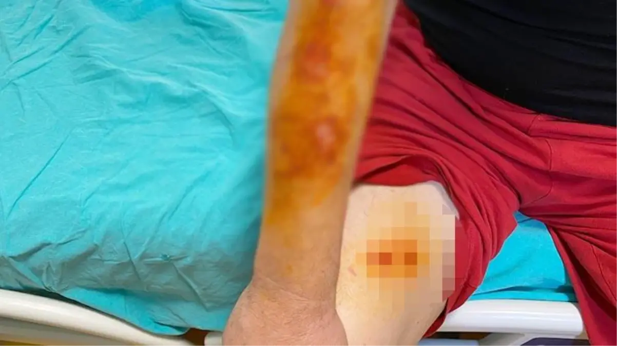 Lavabo açıcı bomba gibi patladı! Canı yanan adam soluğu hastanede aldı