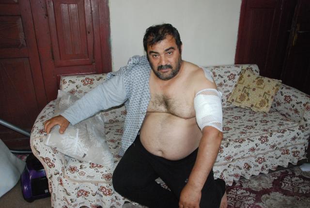 Ayı saldırısına uğrayan vatandaş ölü taklidi yaparak hayatta kaldı Ayı saldırısına uğrayan vatandaş ölü taklidi yaparak hayatta kaldı