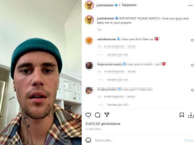 Justin Bieber yüz felci geçirdi! Sadece bir gözünü oynatabiliyor