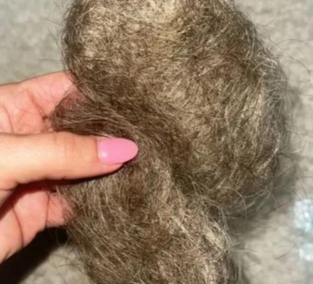 10 yıldır kullandığı doğum kontrol hapını bırakan kadın, her gün kabusu yaşıyor