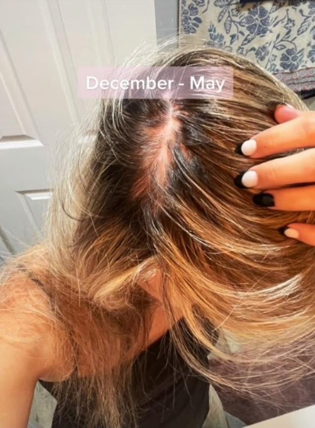 10 yıldır kullandığı doğum kontrol hapını bırakan kadın, her gün kabusu yaşıyor