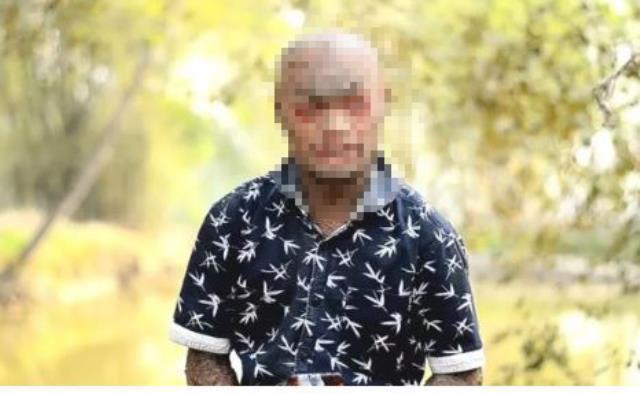 Yılan adamı görenler hayrete düşürüyor! Her hafta düzenli olarak deri değiştiriyor