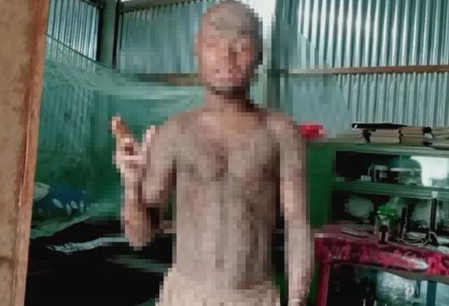 Yılan adamı görenler hayrete düşürüyor! Her hafta düzenli olarak deri değiştiriyor