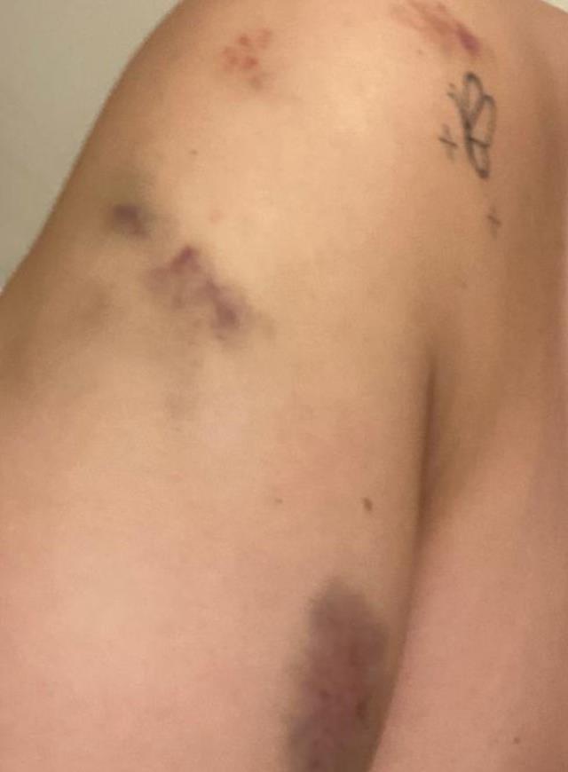 ABB çalışanının eşinden darp iddiası: Beni dövdü, belediye görevlileriyle gelip tehdit etti