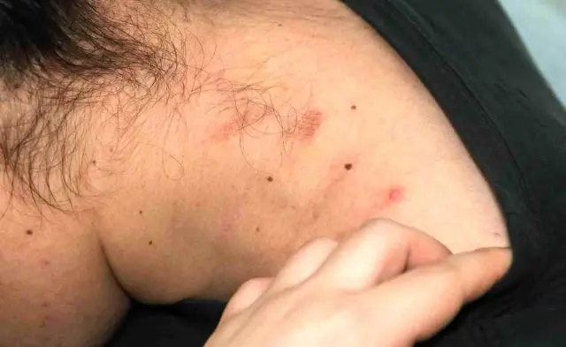 Oğlunun gözü önünde dayak yedi, her yeri mosmor oldu! Arkasındaki neden akıllara zarar