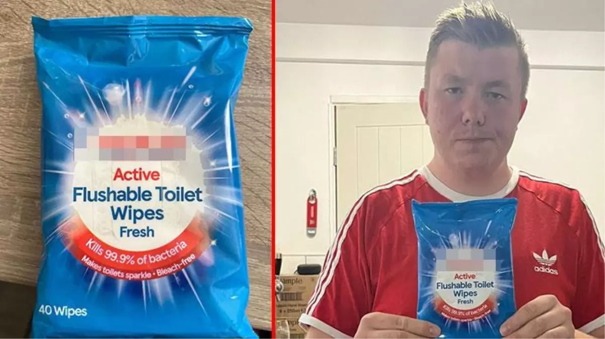 'Bakterileri yüzde 99 öldürür' yazılı paketle cildini silen kamyon şoförü kabusu yaşadı