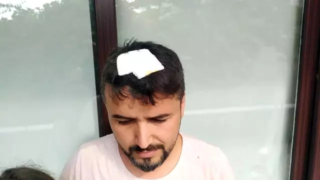 Kafasına yorgun mermi isabet eden kişi, kızının gözü önünde yere yığıldı Kafasına yorgun mermi isabet eden kişi, kızının gözü önünde yere yığıldı