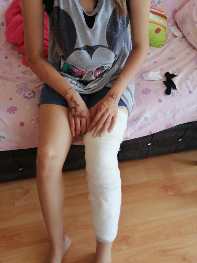 Bir scooter faciası daha! Hızla gelen araç, yolda ilerleyen genç hemşireyi ezdi geçti