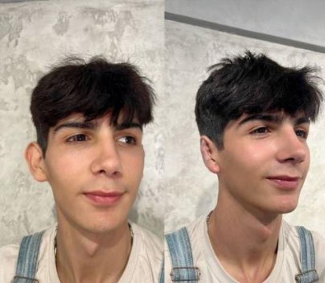 Estetikle bambaşka birine dönüşen fenomen Taha Duymaz, kulaklarını da yaptırdı! İşte son hali