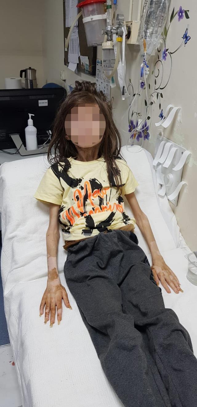 Çöp evde bulunan çocuk ne oldu? Bursa çöp evdeki çocuk nasıl, sağlık durumu nedir?