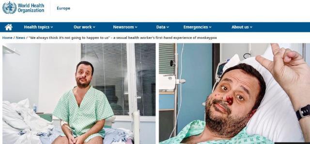 Maymun çiçeğine yakalanan Türk vatandaşı konuştu: Öleceğimi sandım Maymun çiçeğine yakalanan Türk vatandaşı konuştu: Öleceğimi sandım