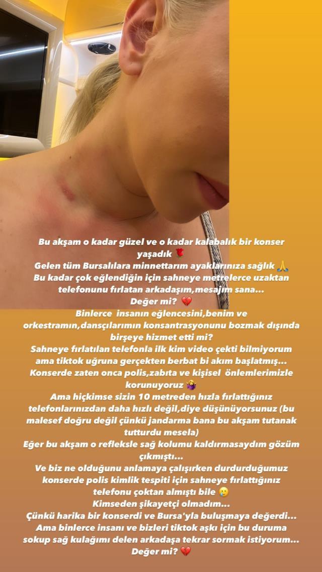 Ece Seçkin'e sahnedeyken telefon fırlatıldı! Boynunu paylaşıp isyan etti