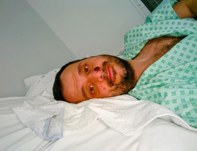 İngiltere'nin konuştuğu Türk! Önce AİDS, sonra korona daha sonra da maymun çiçeği oldu