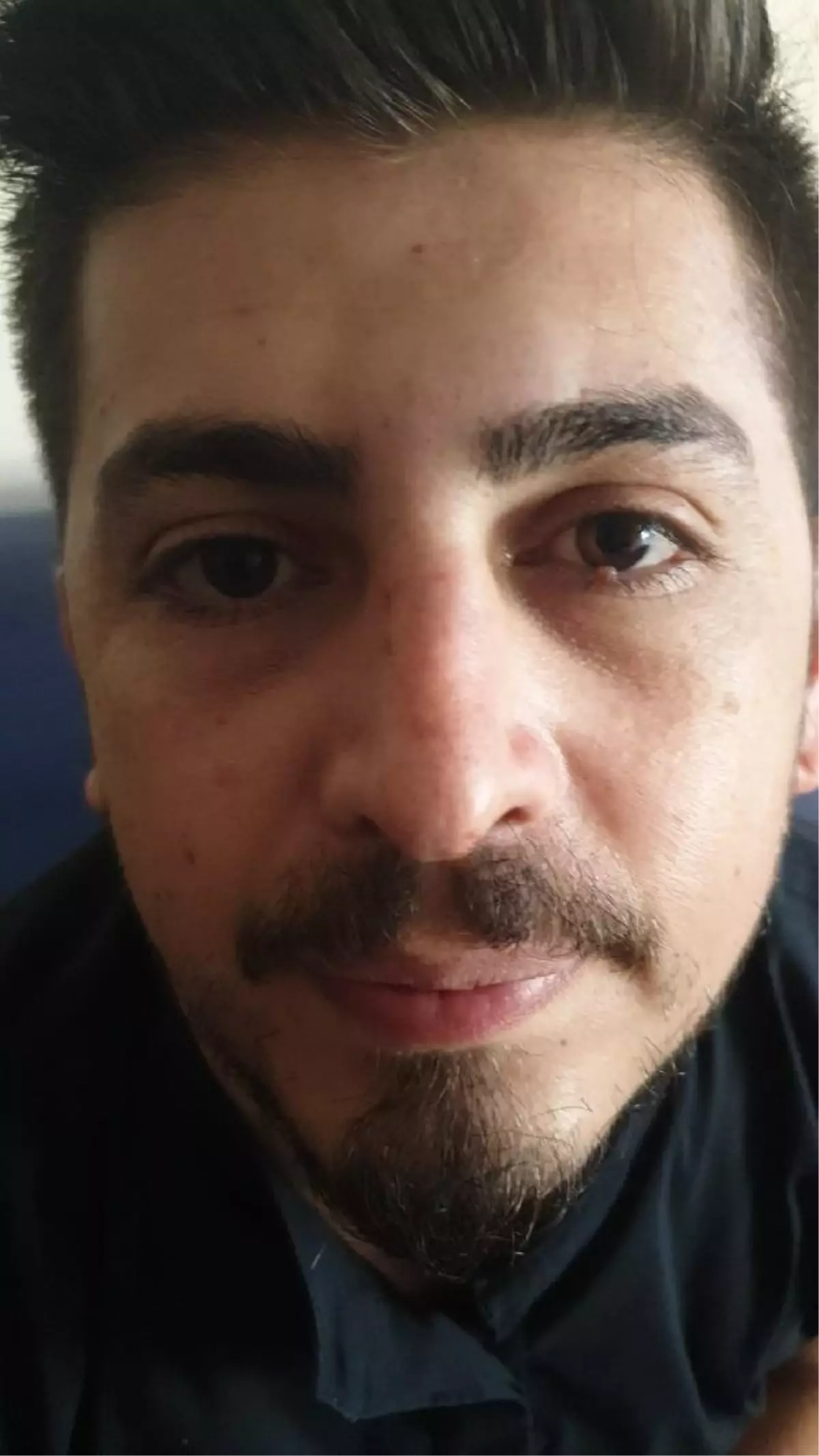 Hemşirenin burnunu kırmıştı; yakalama kararıyla yeniden gözaltında