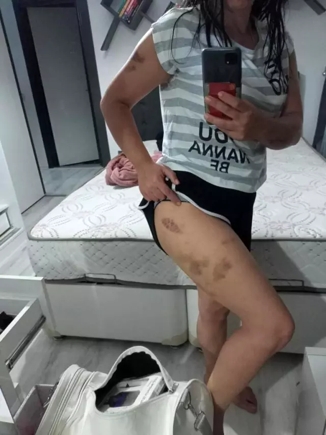 Öz annesi tarafından parayla satıldı, eşinden şiddet gördü! Saime'den yardım çığlığı