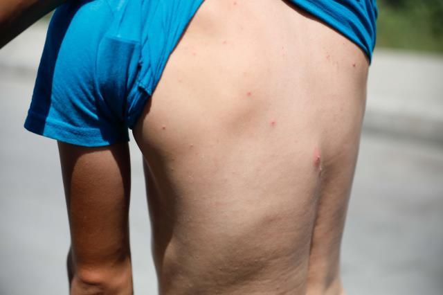 Zika virüsü taşıyan sivrisinekler İstanbul'da görüldü! Birçok mahalle tehlike altında Zika virüsü taşıyan sivrisinekler İstanbul'da görüldü! Birçok mahalle tehlike altında