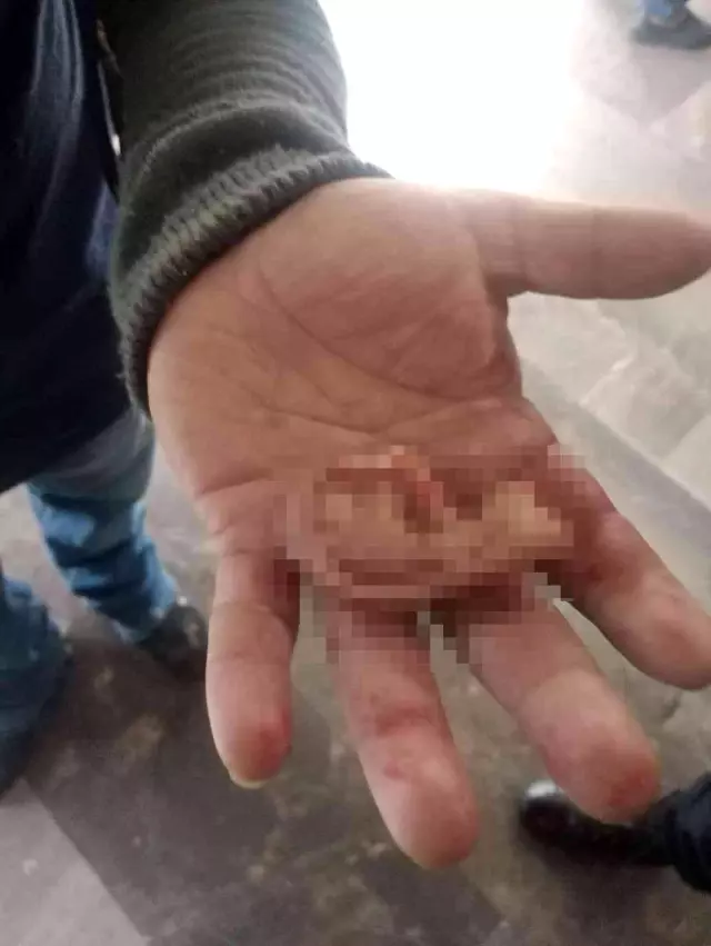 Kadının taciz iddiası metroyu karıştırdı! Kavga edenlerden birinin kulağı koptu