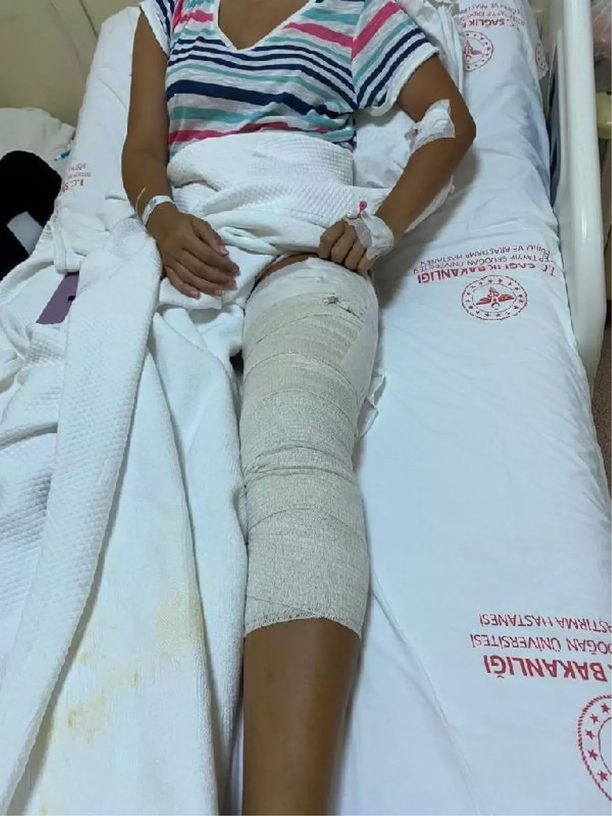 Ece'nin bacağına, yüzerken yorgun mermi isabet etti