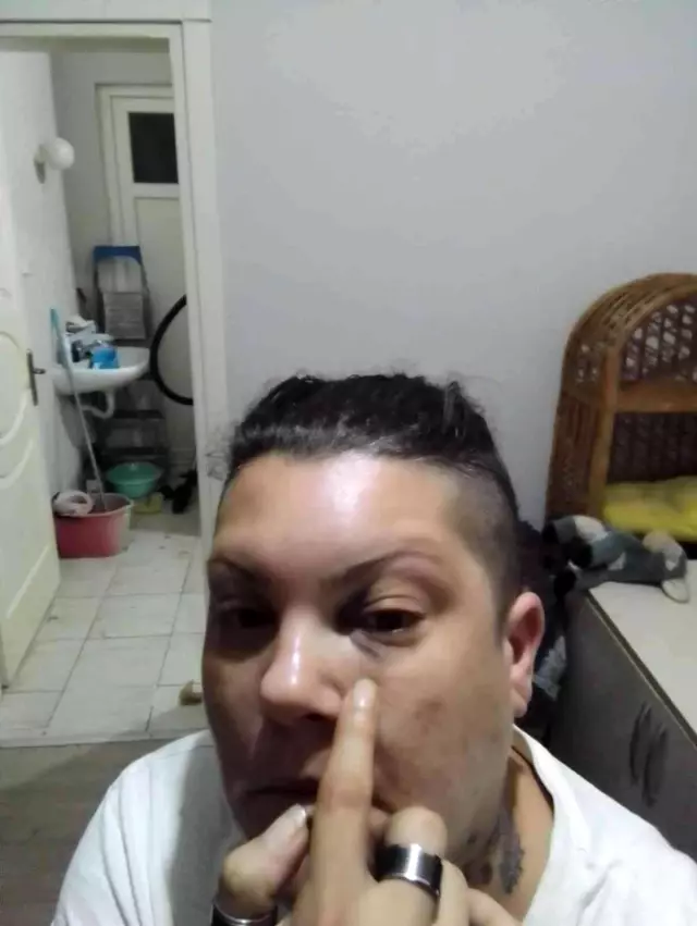 Eski Popstar yarışmacısı Evren Mevlanaoğlu, evinin önünde darp edildi