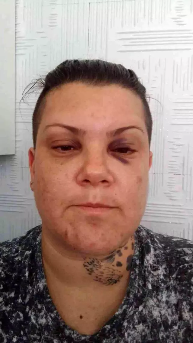 Eski Popstar yarışmacısı Evren Mevlanaoğlu, evinin önünde darp edildi