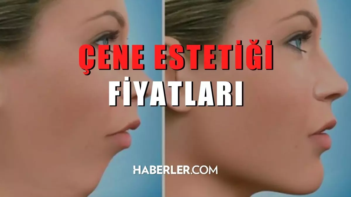 Çene Estetiği Fiyatları 2022: Çene estetiği ne kadar?