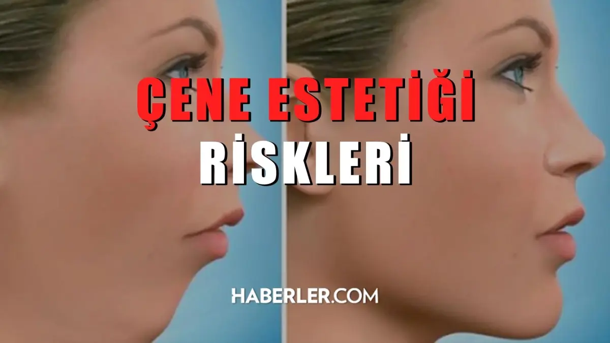 Çene estetiği riskleri nelerdir?