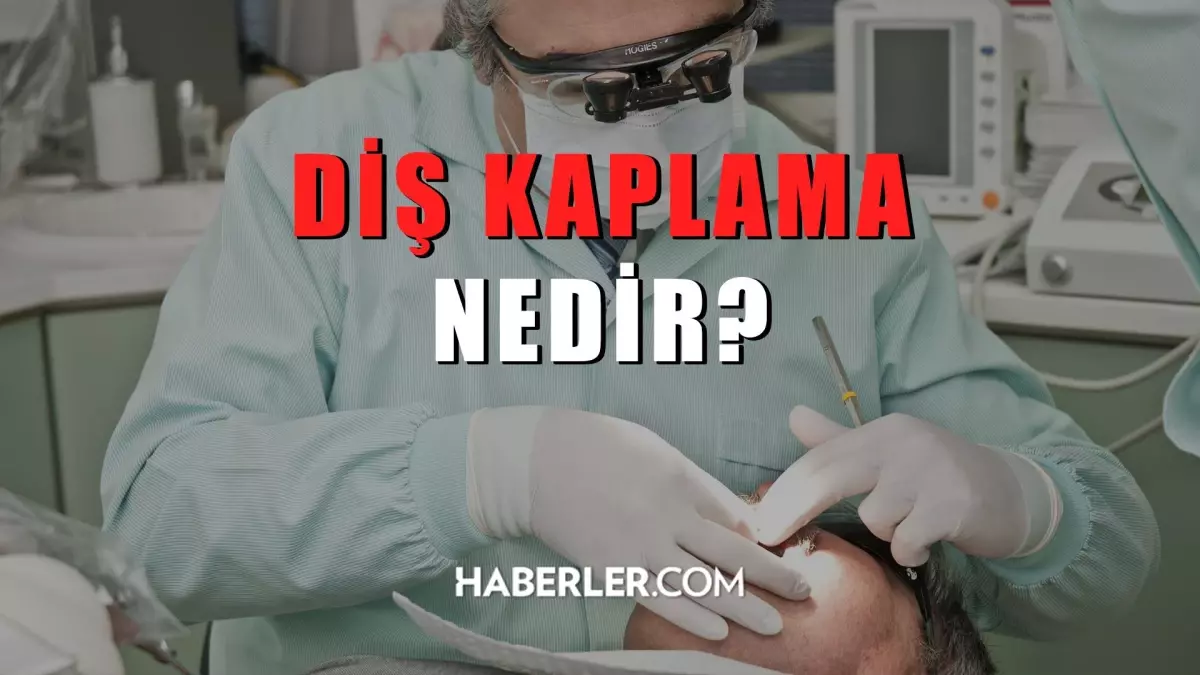 Diş kaplama nedir? Diş kaplama nasıl yapılır?