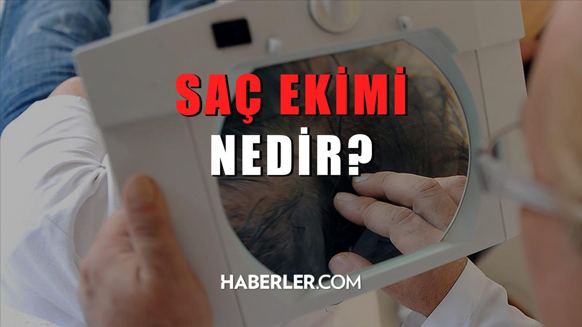 Saç ekimi nedir, nasıl yapılır?