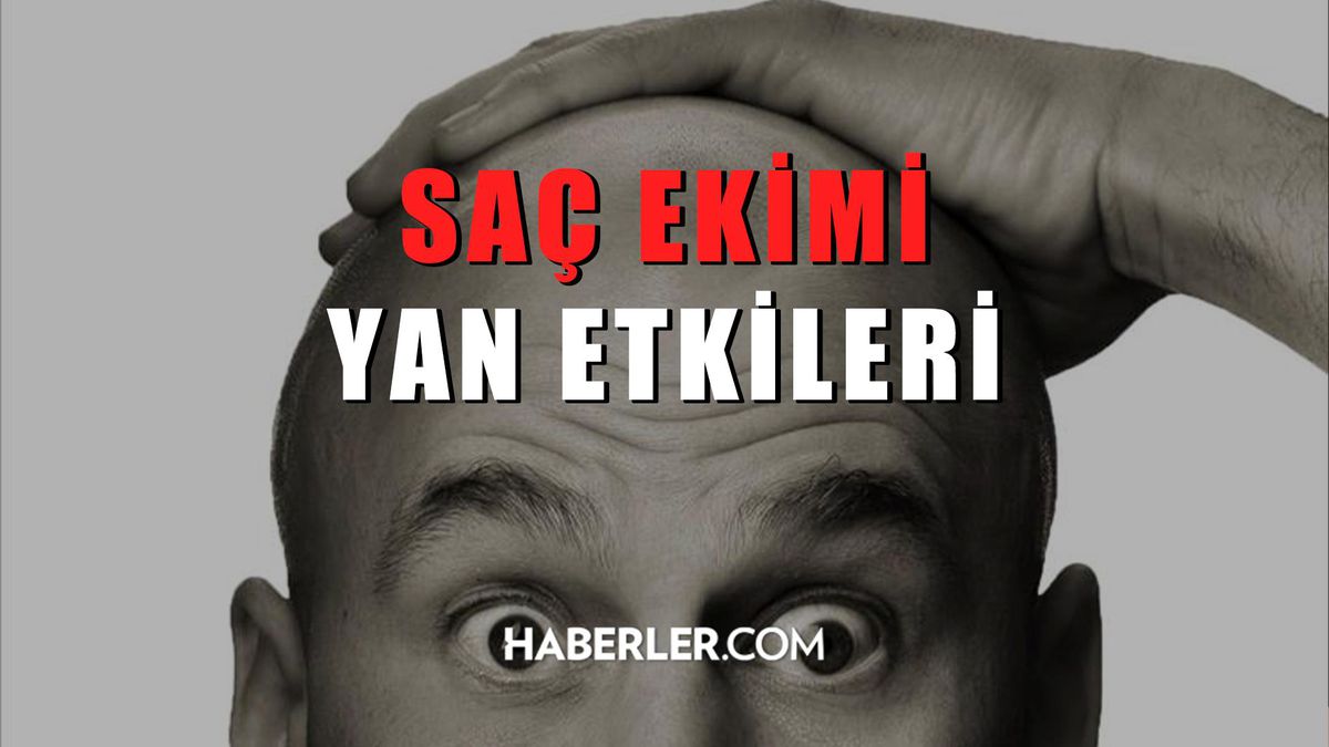 Saç ekimi yan etkileri! Saç ekimi zararları var mı?