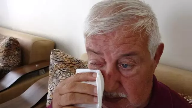 Katarakt ameliyatı için gittiği hastanede gözünü kaybetti Katarakt ameliyatı için gittiği hastanede gözünü kaybetti