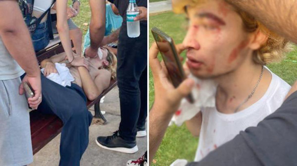 Türkiye şampiyonu milli sporcuya sokak ortasında dayak! Kaykayı ile dövmüşler