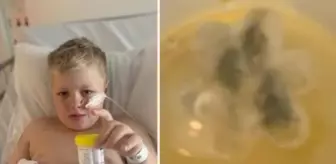 5 yıldır 'astım' teşhisi konulan çocuğun boğazından plastik oyuncak çıktı