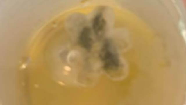 Astım teşhisi konulan çocuğun boğazından plastik oyuncak çıktı Astım teşhisi konulan çocuğun boğazından plastik oyuncak çıktı