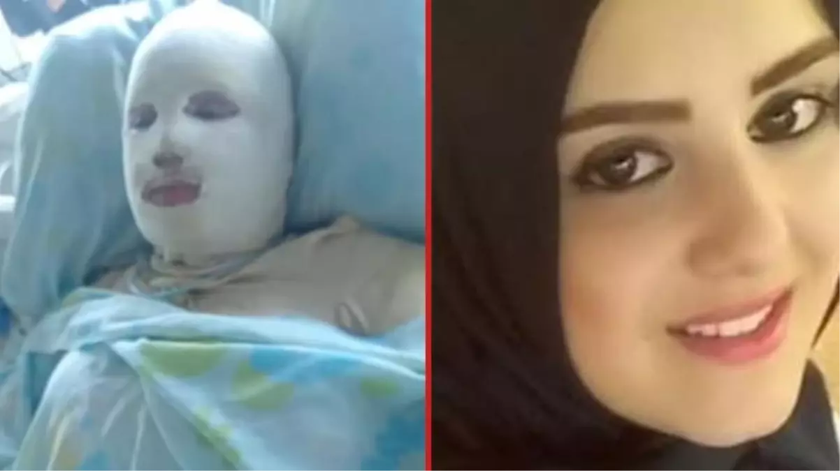 Kürtaj olmayı reddeden hamile eşini gaz tüpüyle yaktı