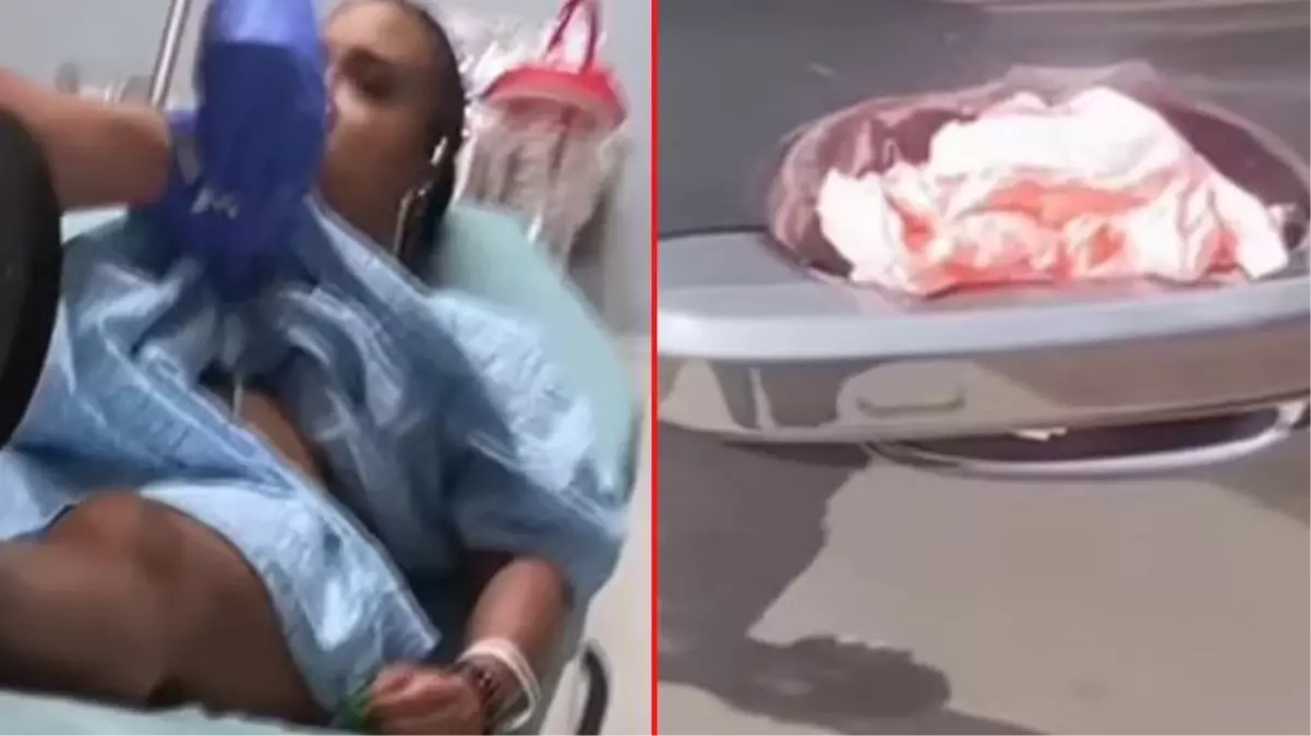 Bir garip olay! Arabasının kapı kolundaki peçeteye dokunan kadın hastanelik oldu