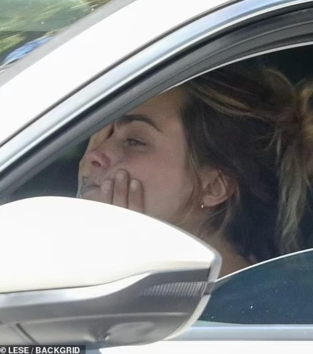 Cinsel ilişki ürünlerinin satıldığı mağazaya giren Cara Delevingne'ın bacağındaki morluklar dikkat çekti