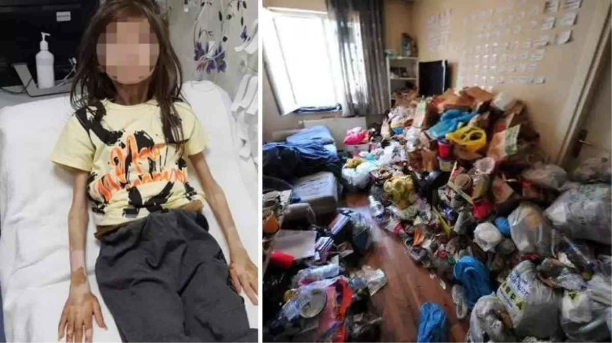 Çöp evde bulunan Cem Muhammet'ten güzel haber! Son halini görenler tanıyamıyor