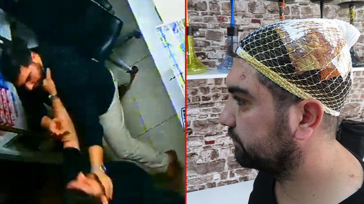 Üsküdar'da akraba dehşeti kamerada: İş yerini basıp asma kilitle kafasını yardılar