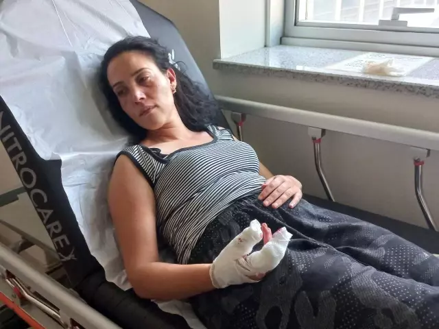 Cinnet getiren öfkeli koca, karısının burnunu kırdıktan sonra parmağını kesti