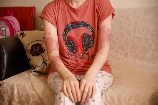 Gaziosmanpaşa'da eski elti dehşeti! 17 kez bıçaklayıp üzerine kaynar su döktü