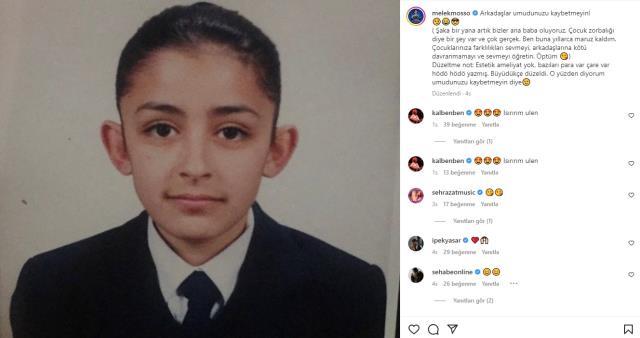 Melek Mosso çocukluk fotoğrafı! Melek Mosso estetikli mi?