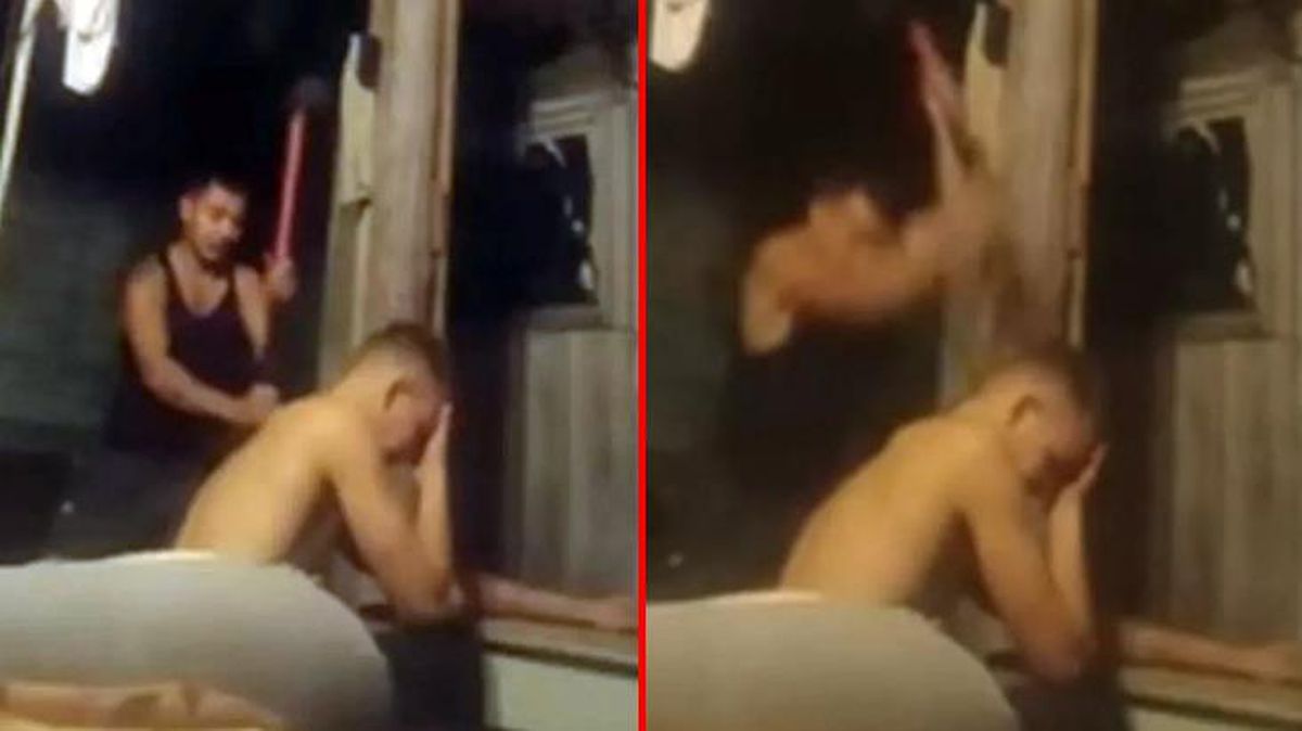 Çektiği acıyı ekran başından hissedeceksiniz! Putin'in ilan ettiği seferberliğe katılmak istemeyen genç, balyozla kolunu kırdırttı
