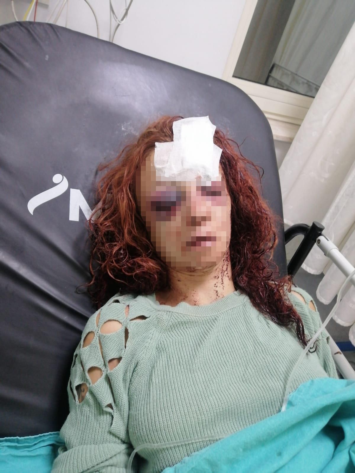 Son dakika haberi: Mersin'de kadını bıçakla ve darbederek yaralayan zanlı ile arkadaşı tutuklandı
