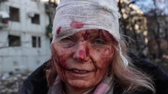 Son dakika haber... AA foto muhabiri Wolfgang Schwan, Rusya-Ukrayna savaşının sembol karesini anlattı Son dakika haber... AA foto muhabiri Wolfgang Schwan, Rusya-Ukrayna savaşının sembol karesini anlattı