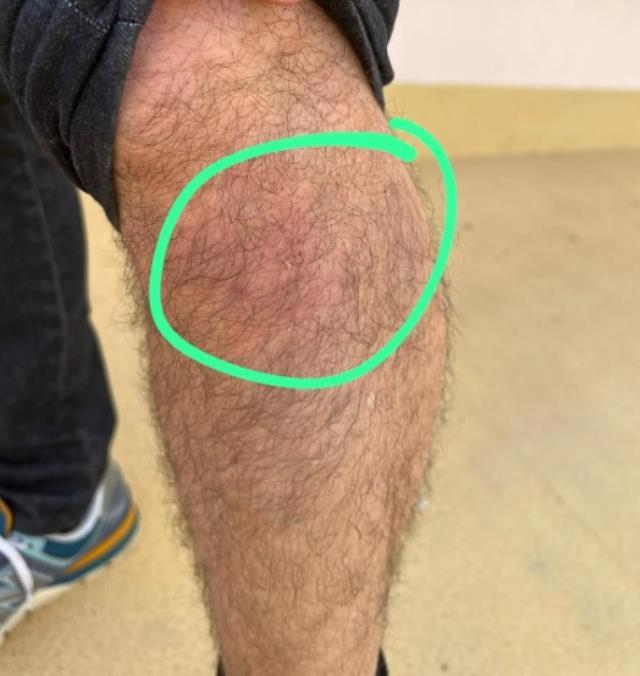 Fransızlardan skandal hareket! Türk taraftarların üzerini arama şekillerine tepkiler çığ gibi