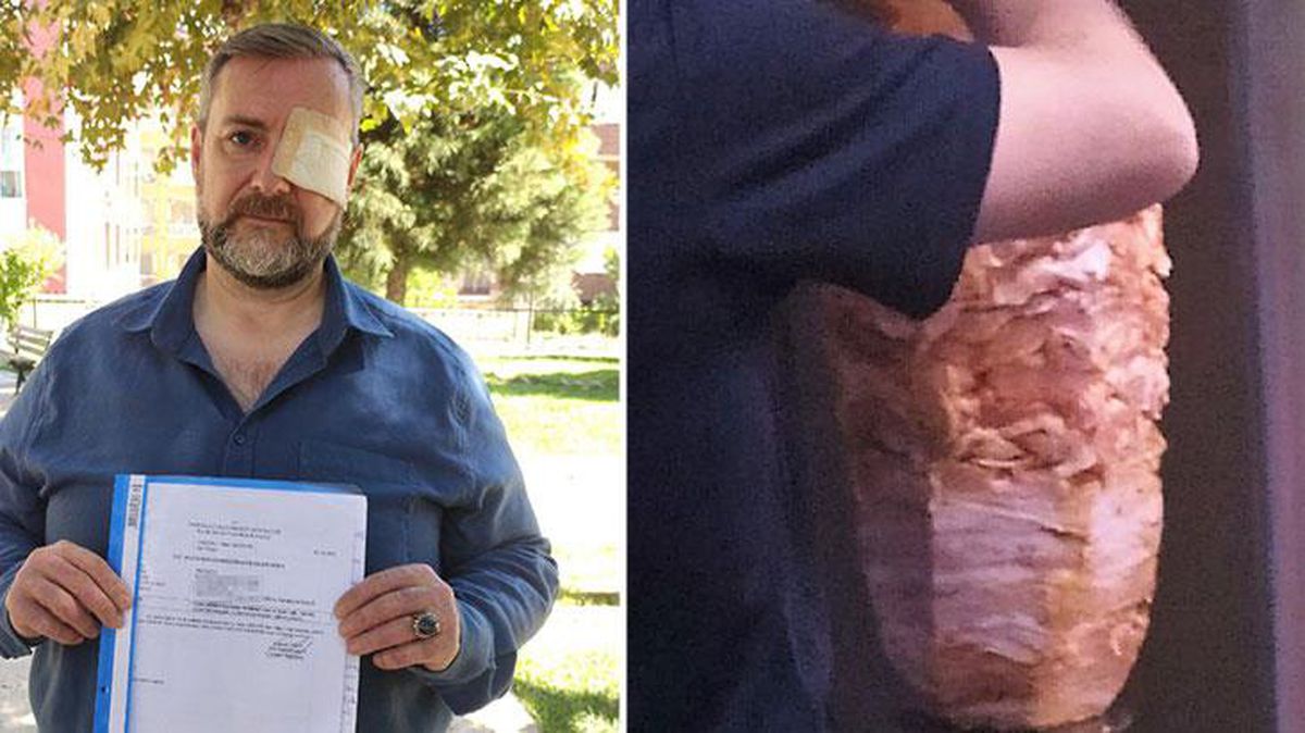 Ünlü döner zincirinin şefi, halka tarihi geçmiş eti satmadı diye dövülüp kör edildi