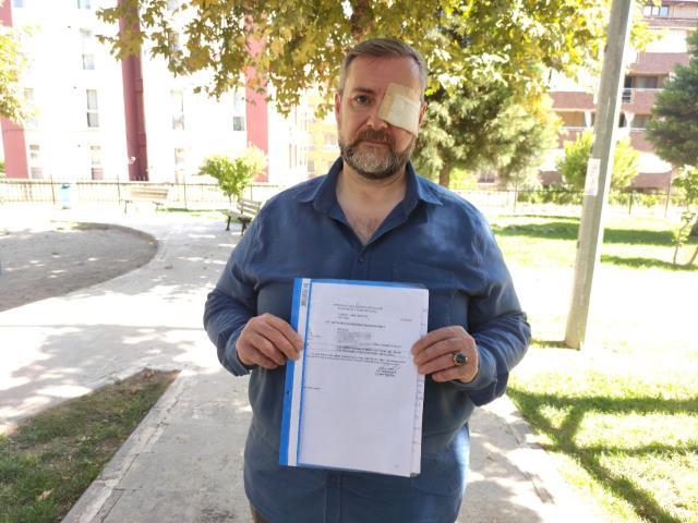 Ünlü döner zincirinin şefi, tarihi geçmiş eti satmadı diye kör edildi