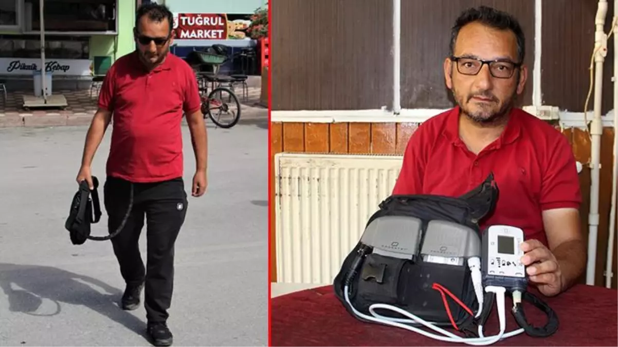 Yapay kalp nakli yapılan hasta: Elimde kalbim ile geziyorum