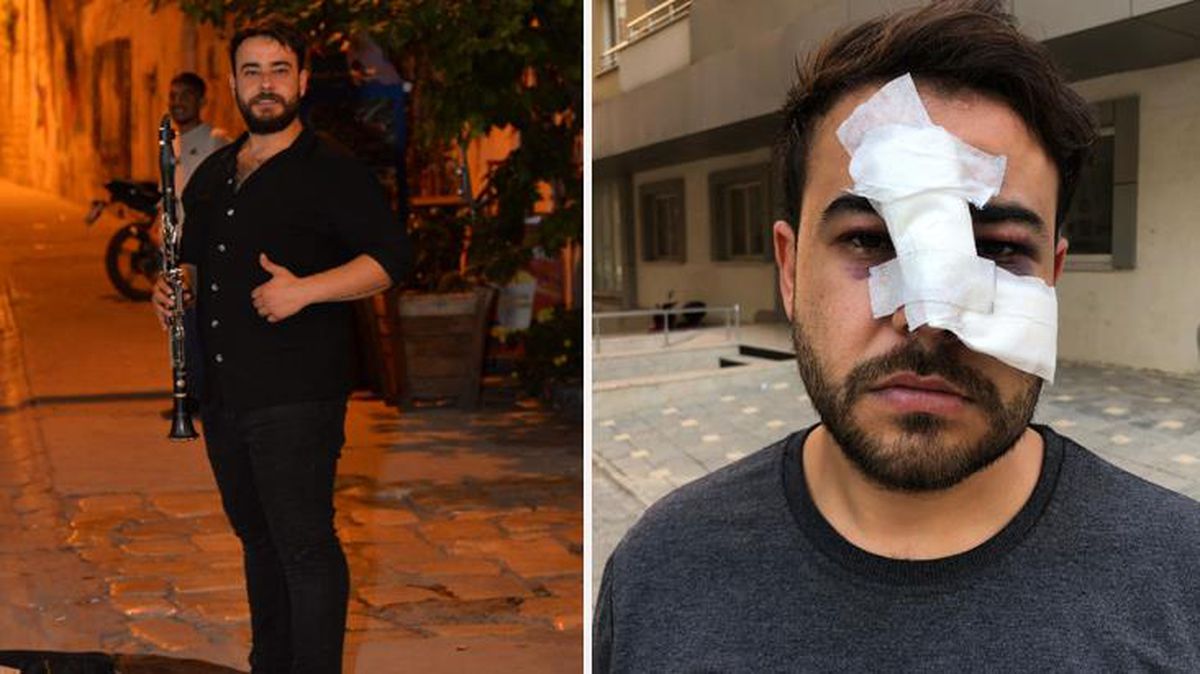 Sokak sanatçısının yüzünde şişe kırıp pişkince 'Biz sana mı vurduk' diye sormuşlar