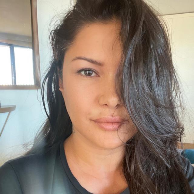 Köpek saldırısında yüzü parçalanan Tuğba Altıntop yaşadıklarını anlattı: Her yer kan revan içindeydi